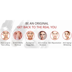 Frakcinis radio dažnio aparatas 2-1