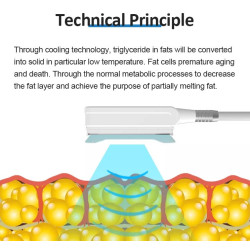 Velashape Cryo kavitacijos vakuumo mašina 2 in 1
