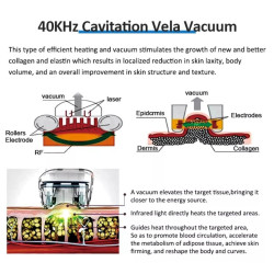 Velashape Cryo kavitacijos vakuumo mašina 2 in 1