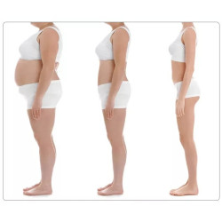 Velashape Cryo kavitacijos vakuumo mašina 2 in 1