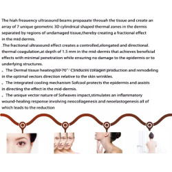 Raukšlių šalinimo ir odos atjauninimo Ultragarso RF aparatas