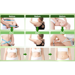 Kavitacijos vakuumo svorio mažinimo RF dažnio odos stangrinimo grožio aparatas