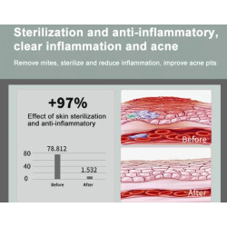 Veido terapijos aparatas Hydra Oxygen M6 odai atjauninti