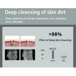 Veido terapijos aparatas Hydra Oxygen M6 odai atjauninti