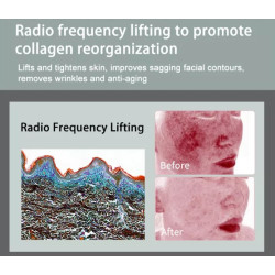 Veido terapijos aparatas Hydra Oxygen M6 odai atjauninti