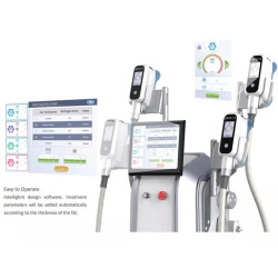 Krioterapijos kriolipolizės 4in1 kūno lieknėjimo aparatas