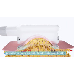 Krioterapijos kriolipolizės 4in1 kūno lieknėjimo aparatas
