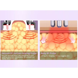 Ultragarso kavitacijos vakuuminis RF lipo lazerinis aparatas