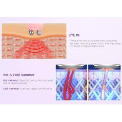 Ultragarso kavitacijos vakuuminis RF lipo lazerinis aparatas