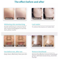 Hydrafacial veido priežiūros aparatas 8-1