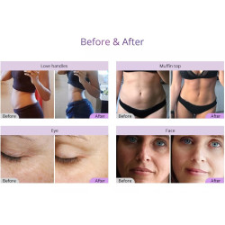 Ultragarso kavitacijos vakuuminis RF lipo lazerinis aparatas