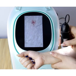 Odos analizatorius HydraFacial 6 funkcijų grožio įranga