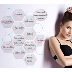 Pikosekundinis lazeris 1064 532 nm