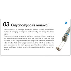 Diodinis lazeris 980nm kraujagyslių vorinių venų šalinimo aparatas  6-1