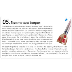 Diodinis lazeris 980nm kraujagyslių vorinių venų šalinimo aparatas  6-1