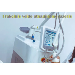 Frakcinis RF lazerinis veido atnaujinimui makšties stangrinimo aparatas