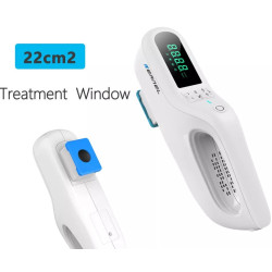 Psoriazės vitiligo psoriazės egzemos grybelinės mikozės eksimerinis 308nm lazeris UV lempa