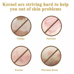 Psoriazės vitiligo psoriazės egzemos grybelinės mikozės eksimerinis 308nm lazeris UV lempa