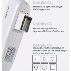 Psoriazės vitiligo psoriazės egzemos grybelinės mikozės eksimerinis 308nm lazeris UV lempa