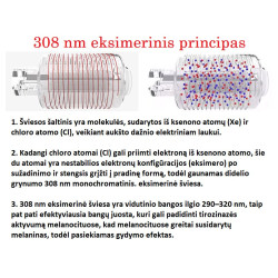 Excimer 308 nm lazeris