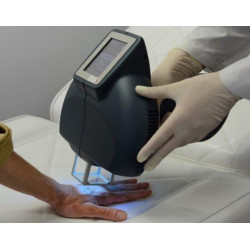 Excimer 308 nm lazeris