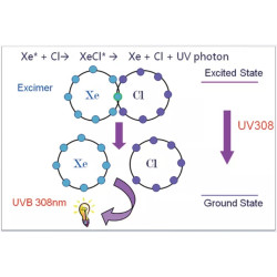 Excimer 308 nm lazeris