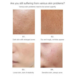 Veido odos atjauninimo RF prietaisas