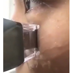 Veido odos priežiūra šviesinimas tamsių ratų odos balinimo aparatas