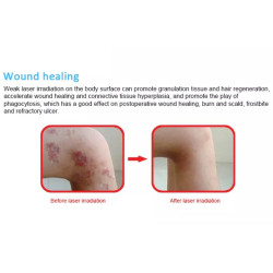 Daugiafunkcis lazerinės terapijos aparatas