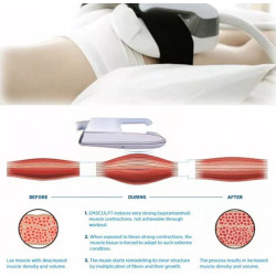 Funkcinis magnetinis stimuliatorius EMS 4