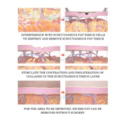 Velashape 3 Aparatas Mini 4in1