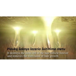 Plaukų šalinimo sistema IPL