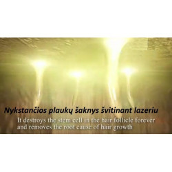 Plaukų šalinimo sistema IPL