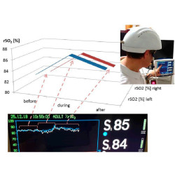 Transkranijinis smegenų kartografavimo įrenginys
