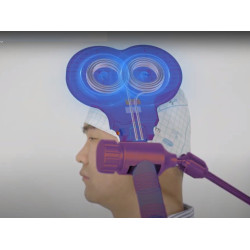 Transkranijinis magnetinis smegenų stimuliatorius