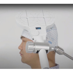 Transkranijinis magnetinis smegenų stimuliatorius