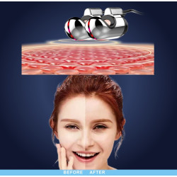 Vakuuminis RF veido ir kūno priežiūros aparatas