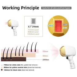 Epiliacijos diodo lazeris 808