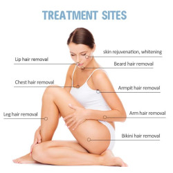 Epiliacijos diodo lazeris 755 808 1064 nm