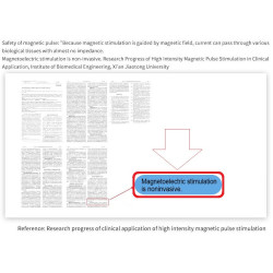 Robotas kūno formavimui EMS CRYO