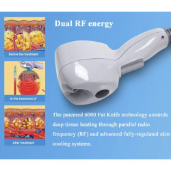 Exili ultra 360 RF veido liftingas kūno lieknėjimo aparatas