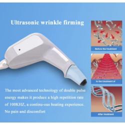 Exili ultra 360 RF veido liftingas kūno lieknėjimo aparatas