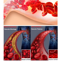 TERAPIJOS APARATAS DIABETINIŲ KOMPLIKACIJŲ LIGŲ GYDYMUI