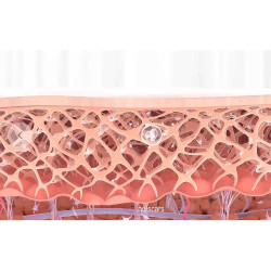 ND YAG pikosekundinis tatuiruočių šalinimo lazeris