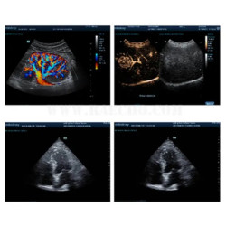 Doplerio ultragarso diagnostinis aparatas