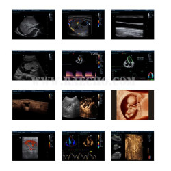Doplerio ultragarso diagnostinis aparatas