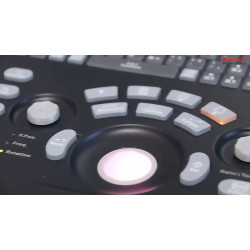 Mindray skaitmeninis ultragarso aparatas