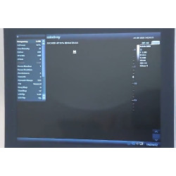 Mindray skaitmeninis ultragarso aparatas