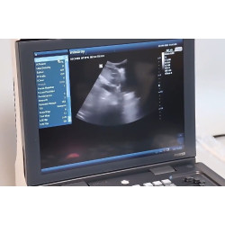 Mindray skaitmeninis ultragarso aparatas