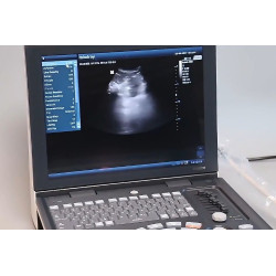 Mindray skaitmeninis ultragarso aparatas